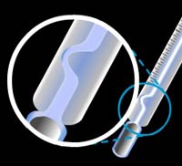 Use of kink in a clinical thermometer